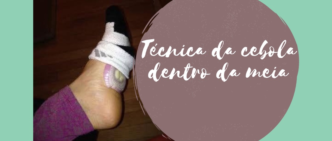 Técnica da cebola dentro da meia